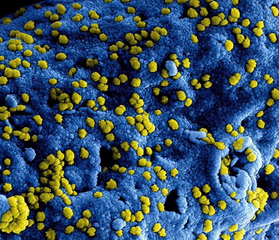 Optimización de plásticos con un nuevo aditivo antimicrobiano Optimización de plásticos con un nuevo aditivo antimicrobiano