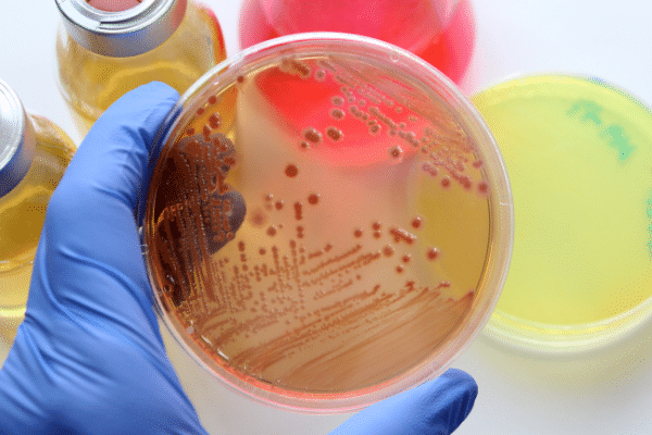 La importancia de la microbiología alimentaria en los procesos de calidad La importancia de la microbiología alimentaria en los procesos de calidad