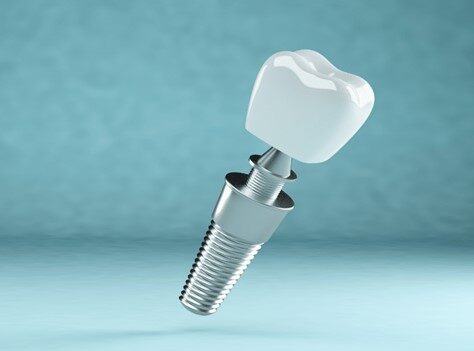 Biocompatibility Testing to Approve New Materials and Manufacturing Methods