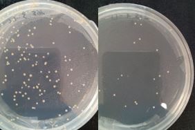 Evaluación de desinfección mediante LED ultravioleta para optimizar eficacia en textiles y superficies Placas de cultivo con colonias bacterianas utilizadas para evaluar la eficacia de desinfección mediante LED ultravioleta antes y después del tratamiento