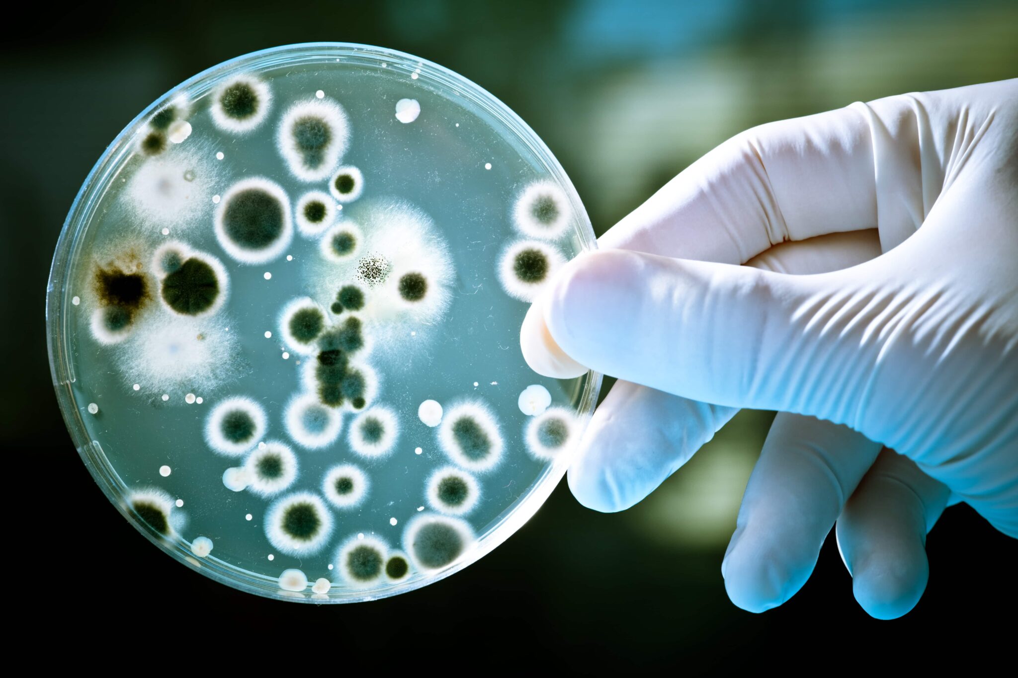 Microbiology, antimicrobial efficacy and biofilm tests Microbiology, antimicrobial efficacy and biofilm tests